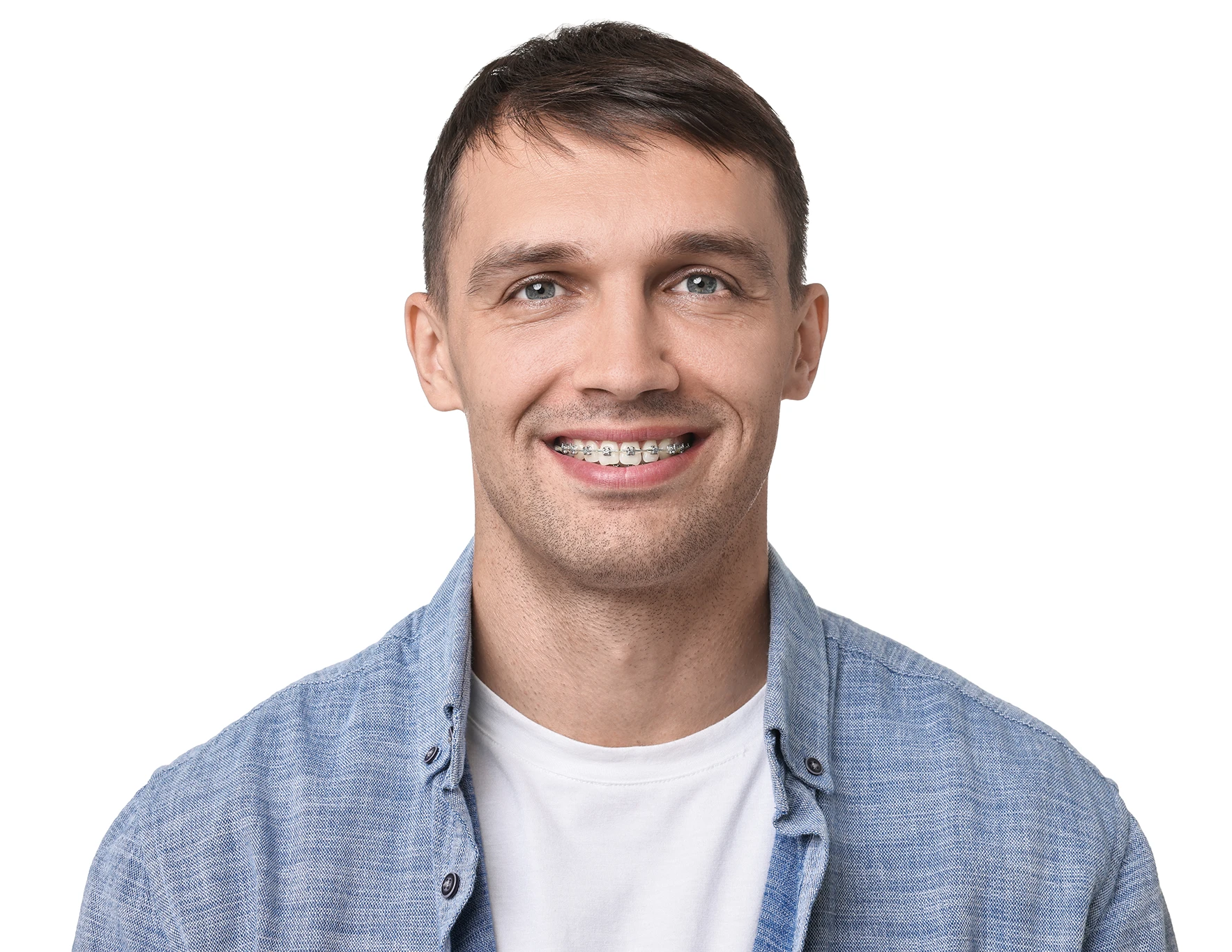 Die beste Zahnspange für Erwachsene: Welche Lösung passt wirklich zu Ihnen?