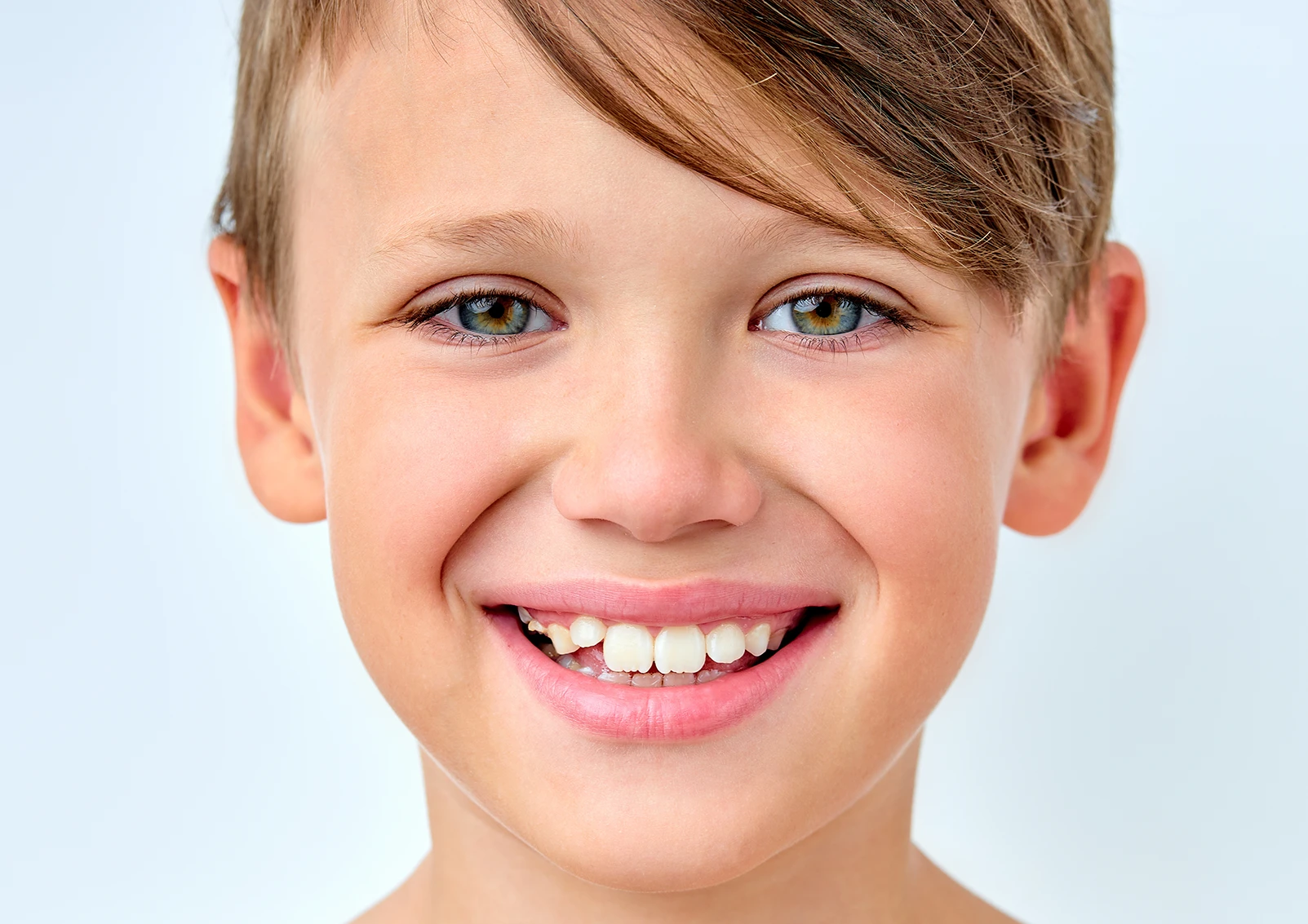 Kind mit leicht schief stehenden bleibenden Schneidezähnen während des Zahnwechsels als Beispiel für die kieferorthopädische Entwicklung im Kindesalter.
